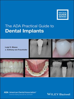 cover image of The ADA Practical Guide to Dental Implants